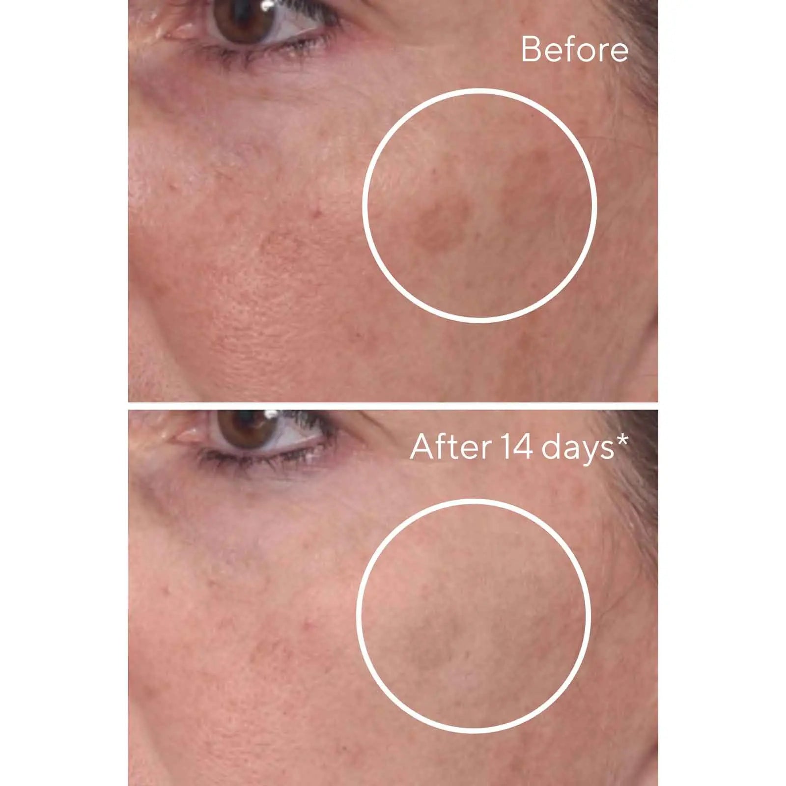 Rapid Dark Spot Correcting Serum