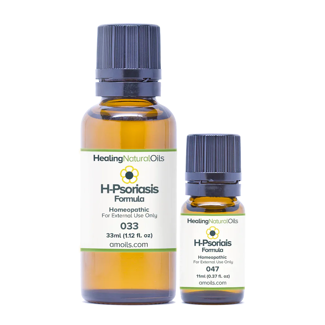 H-psoriasis formula for psoriasis